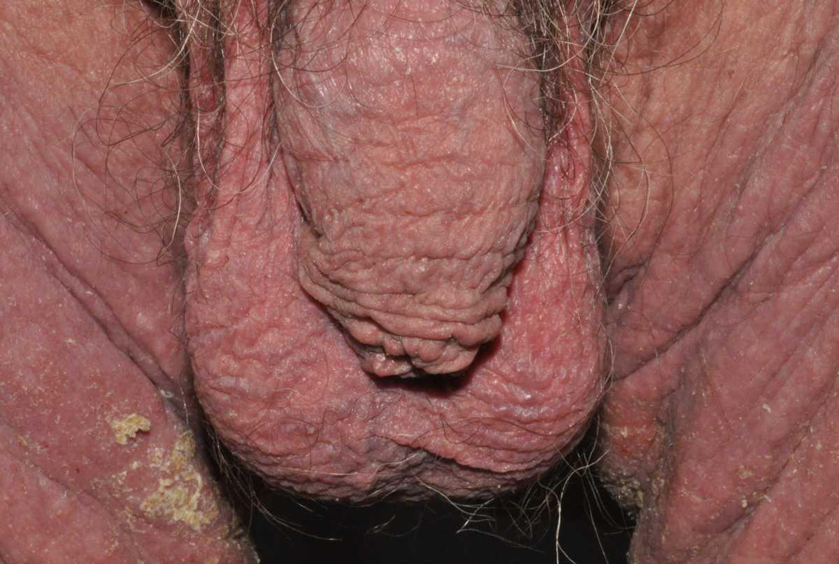 42540260-36356580