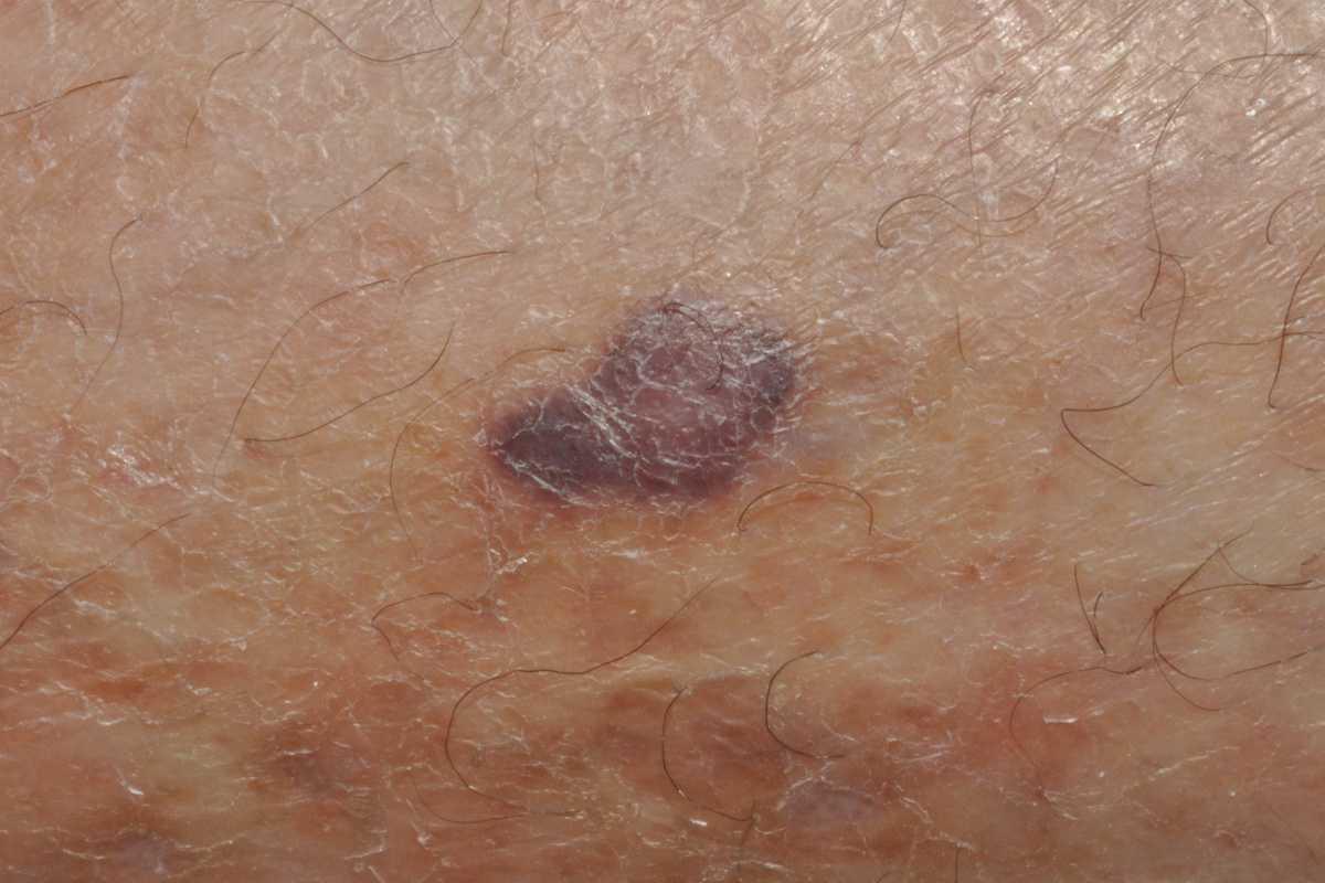 42540260-35457482