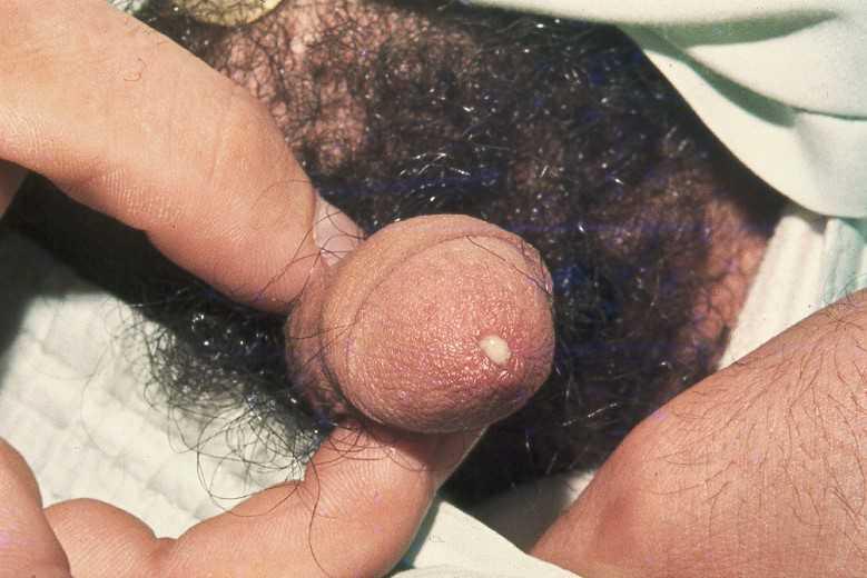 42540260-35459491