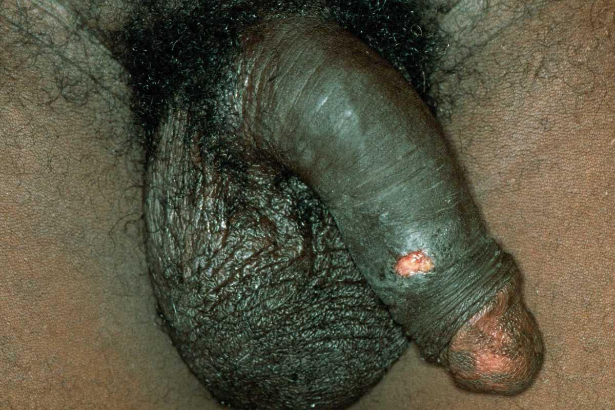 42540260-35461041