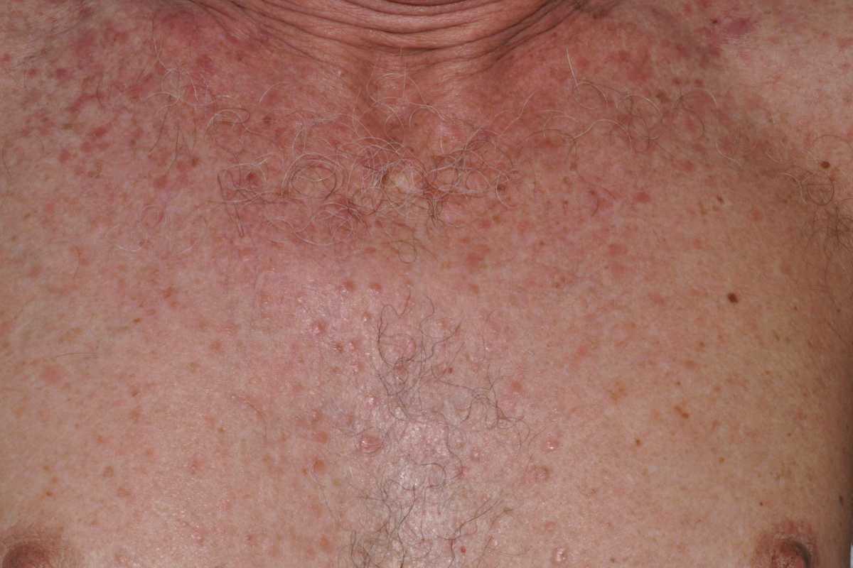 42540260-36073007
