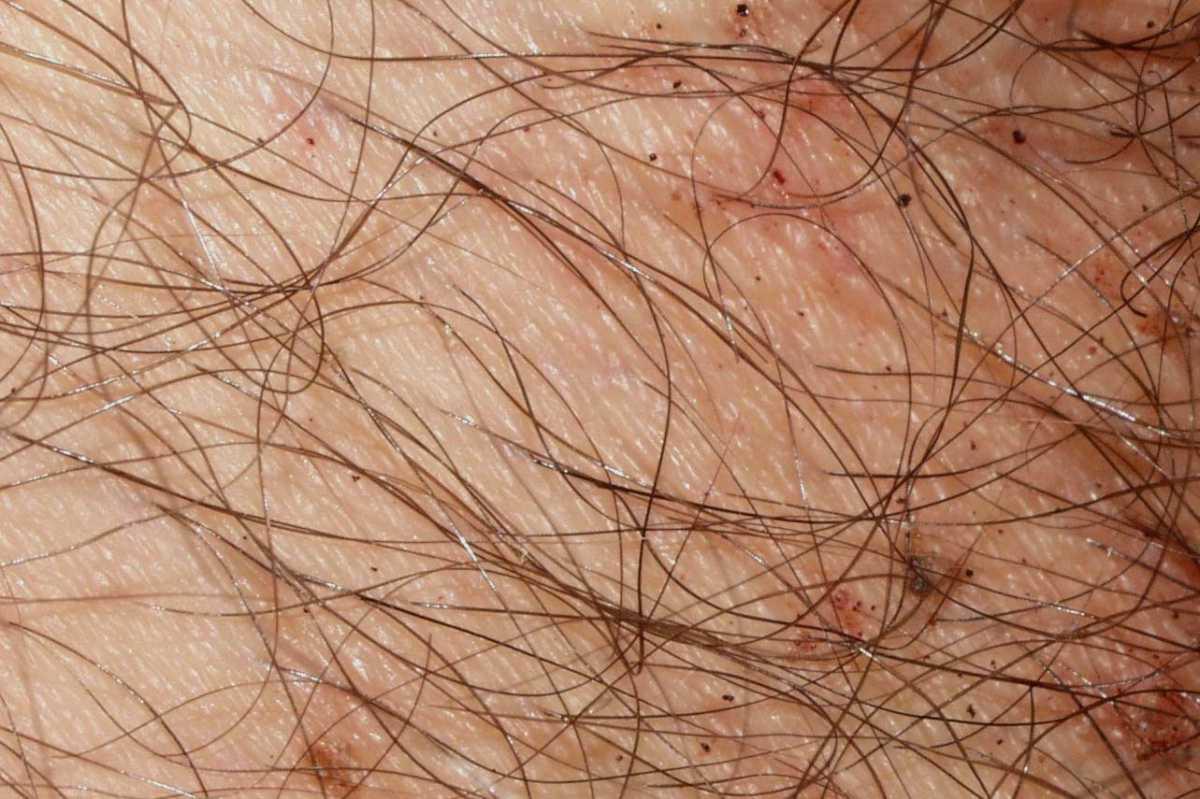 42540260-36376617