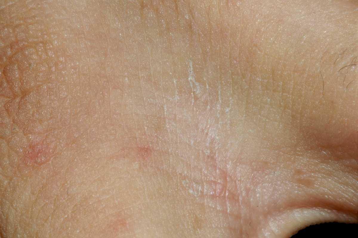21754957-30611067