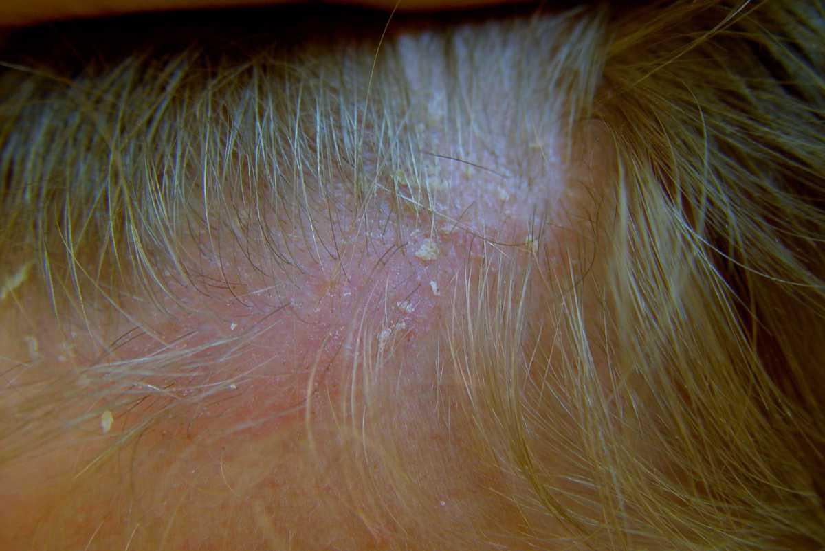 21755004-25873938