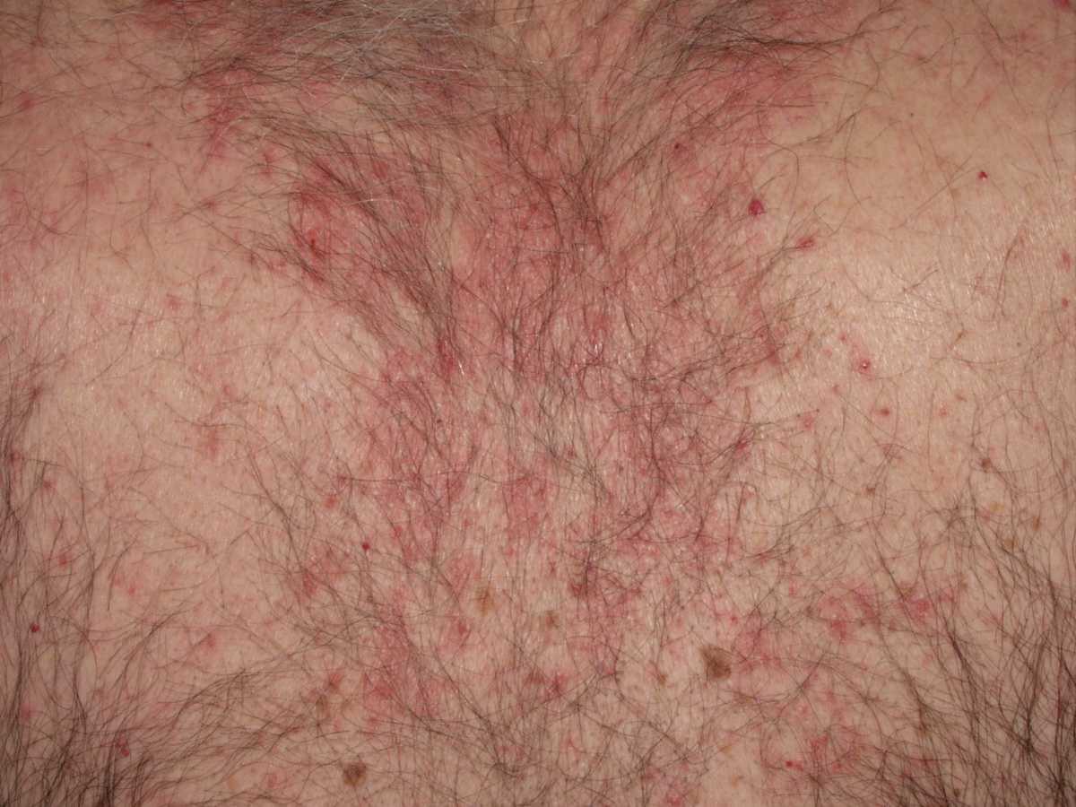 21755004-25873963
