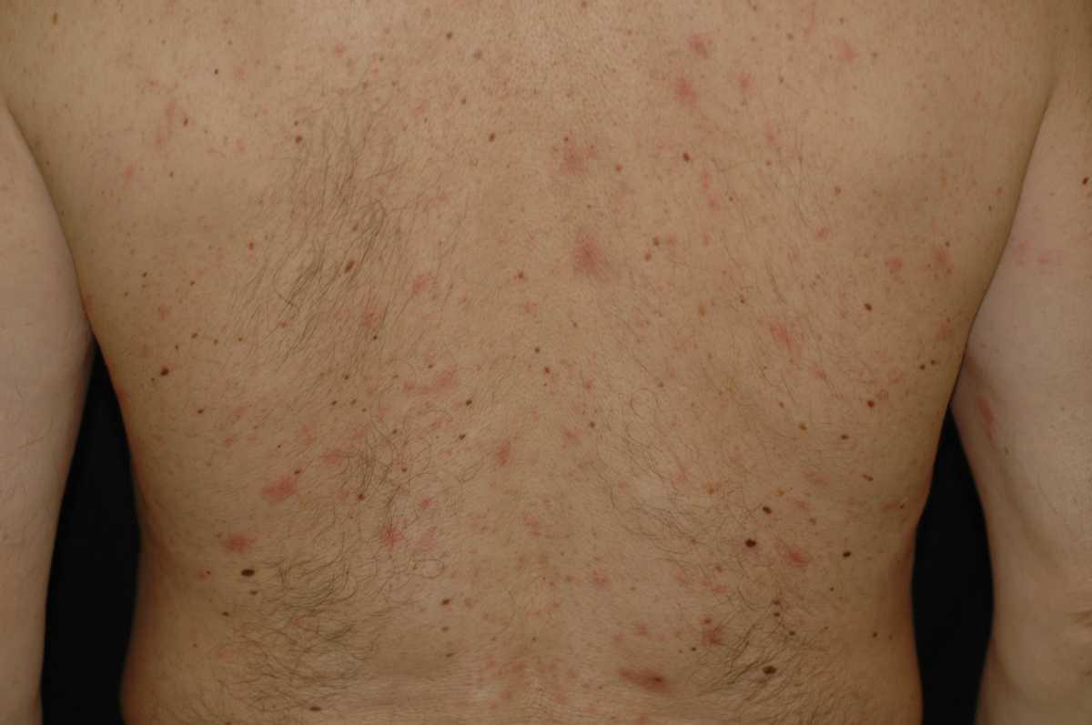 21755004-25899939