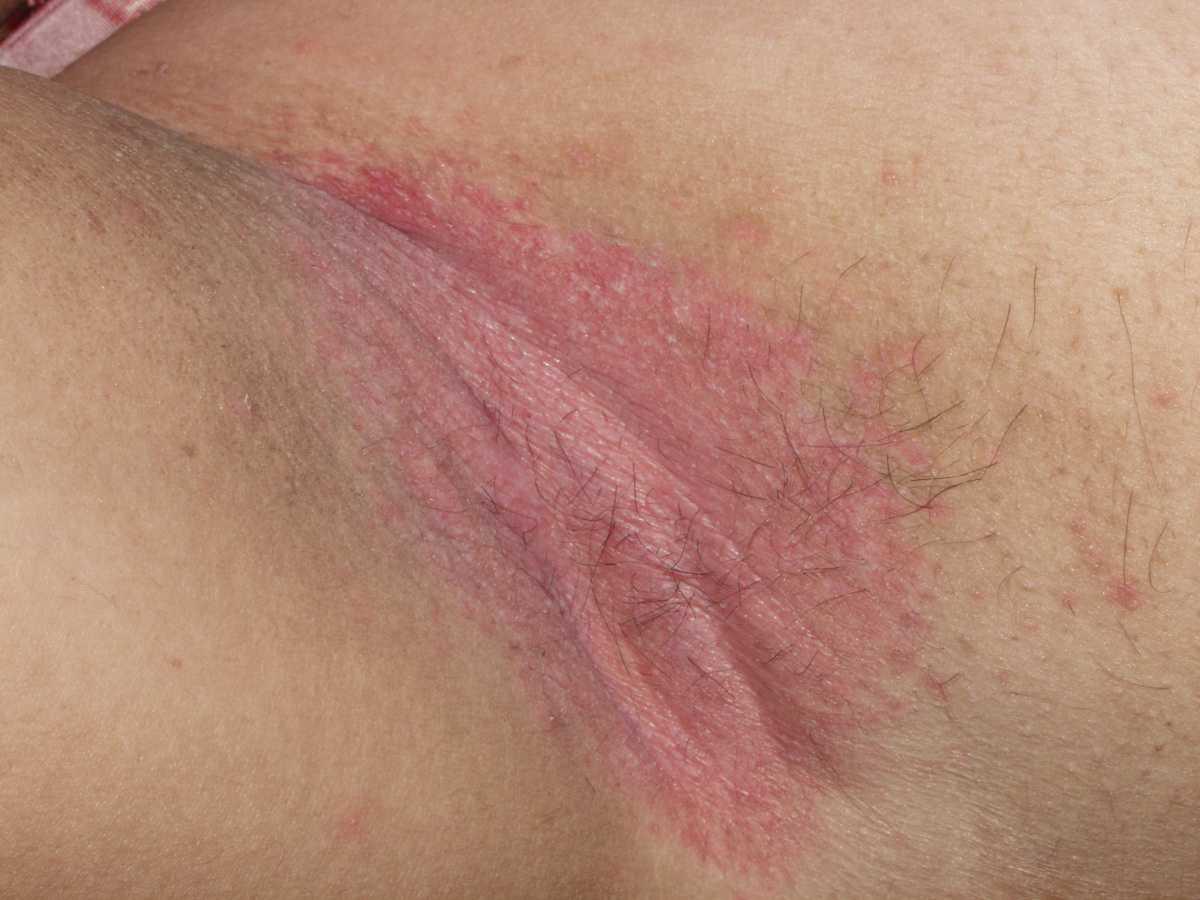 21755004-36760227