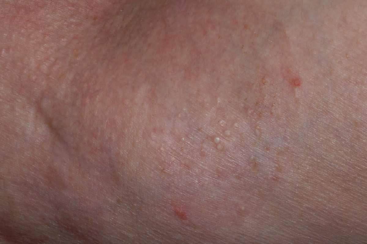 21755054-26382928
