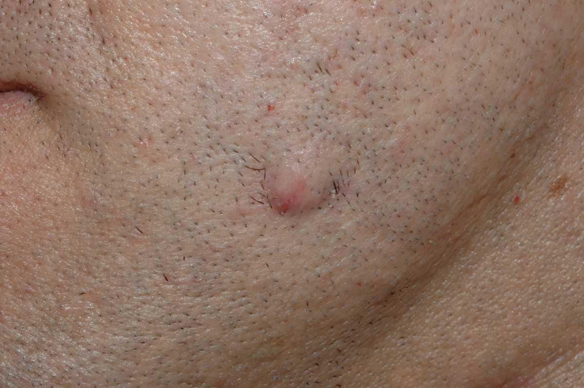 21755054-26382956