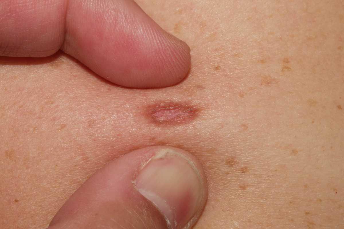 21755054-26388664