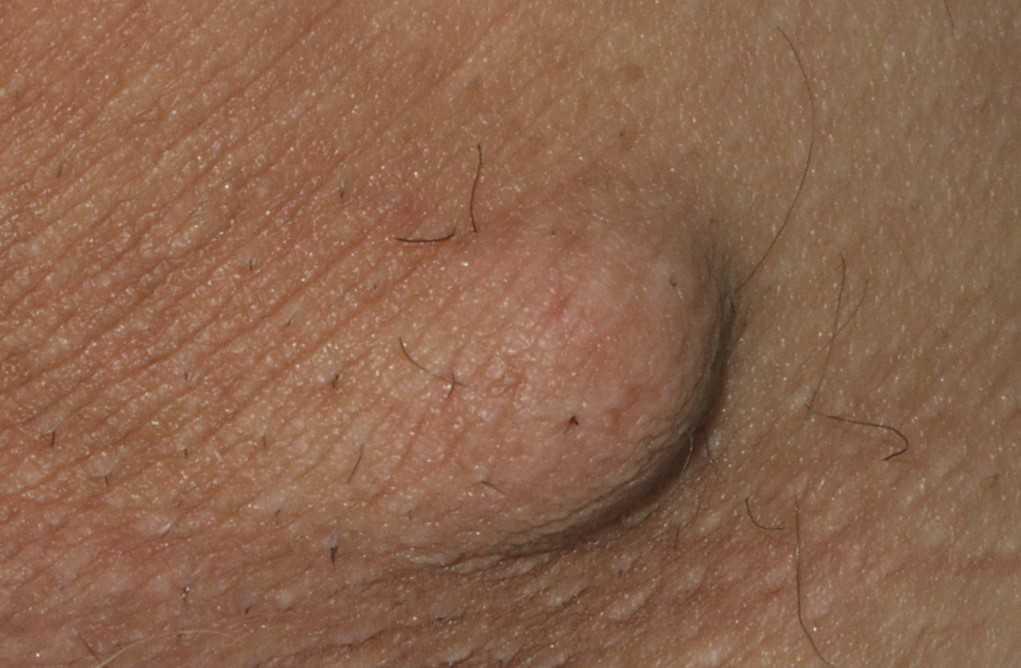 21755054-26391864