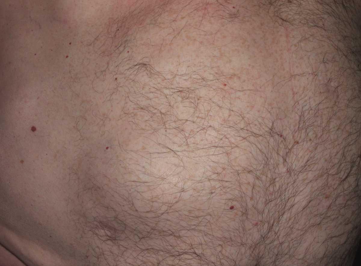 21755054-26391866