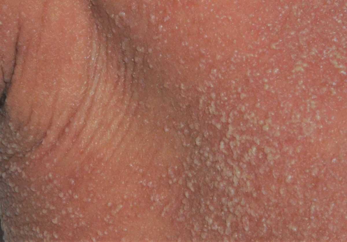28815000-36875289