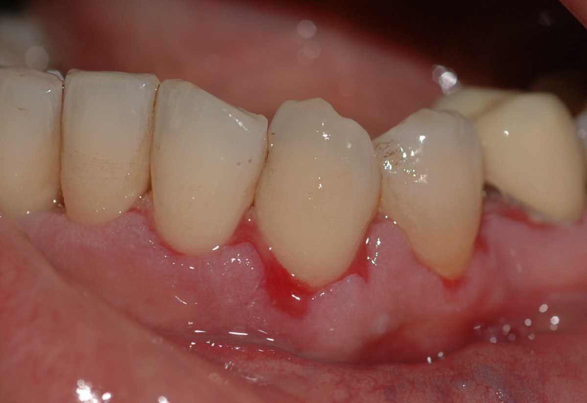 44820486-36476139