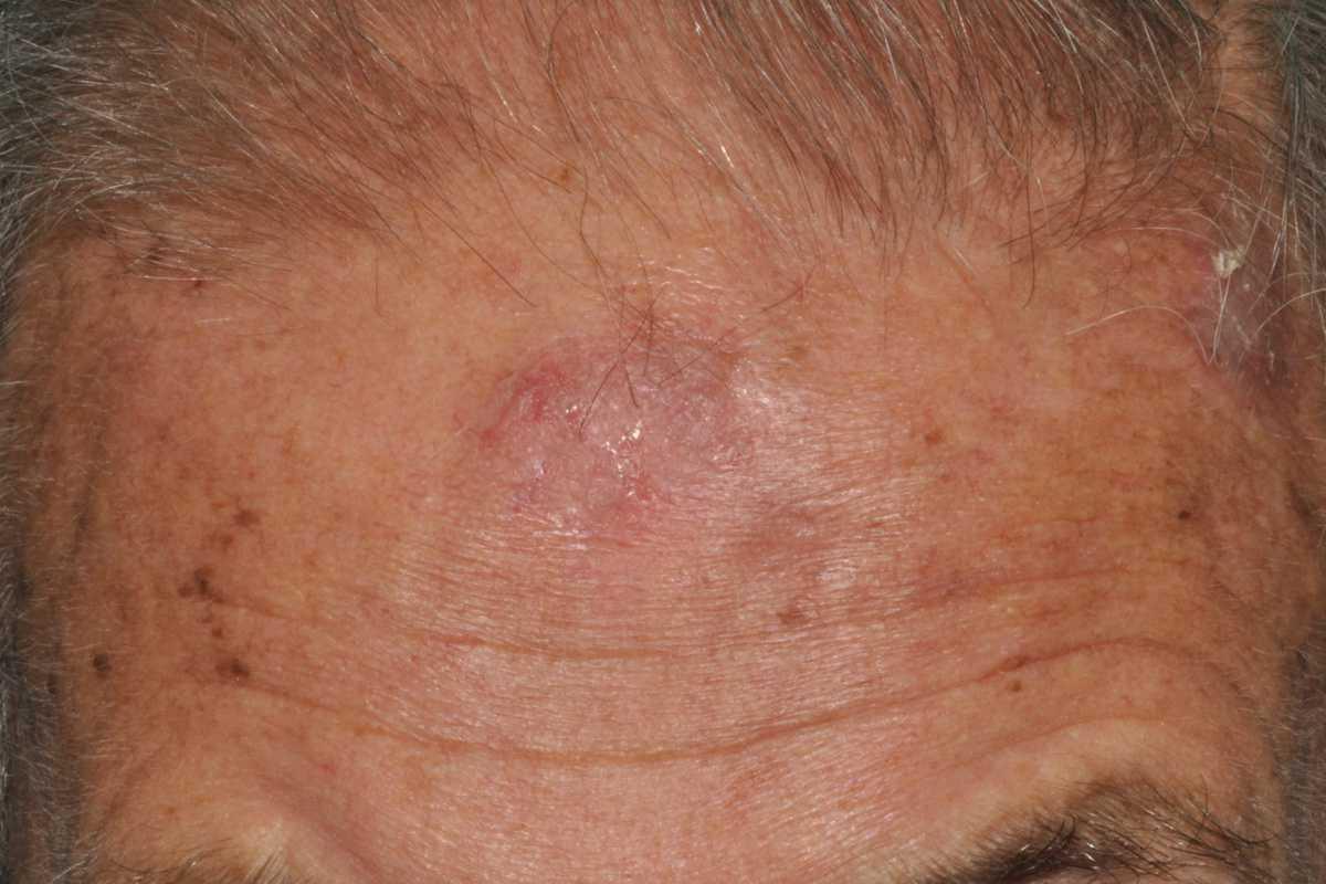 44820486-36481758