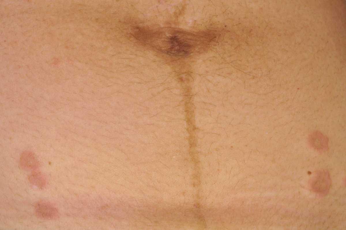 44820486-36489799
