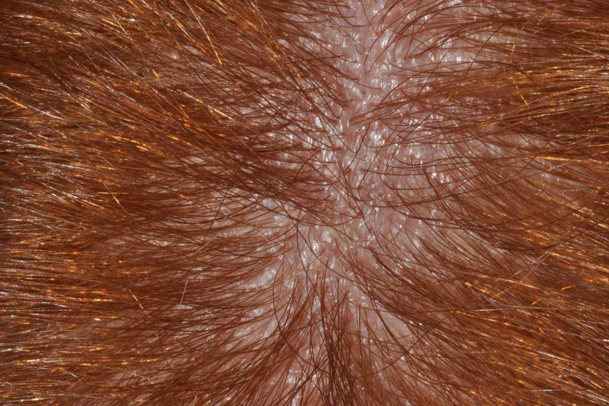 21755046-31020524