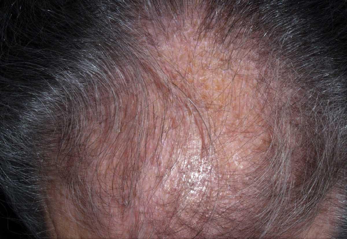 21755046-31020523