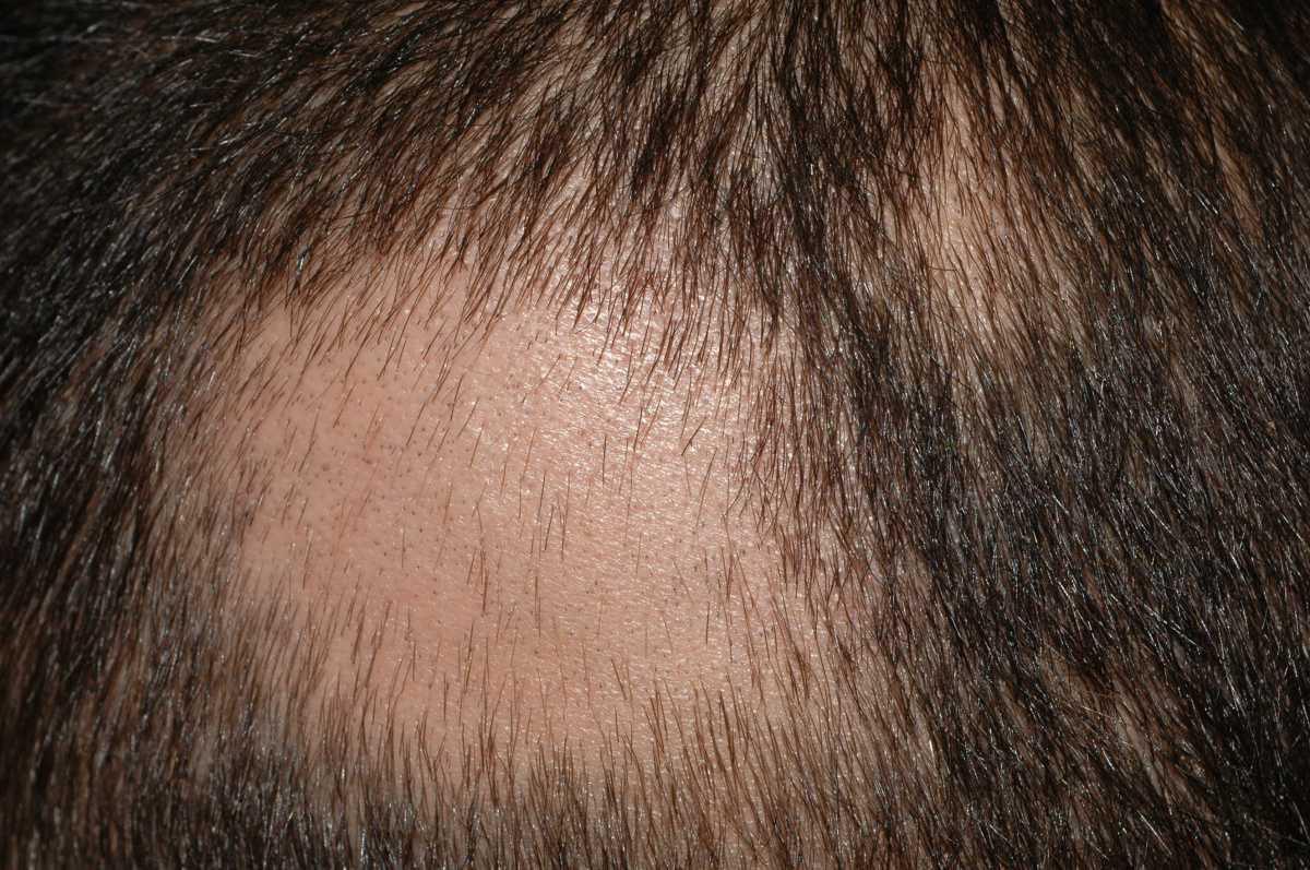21755046-31021337