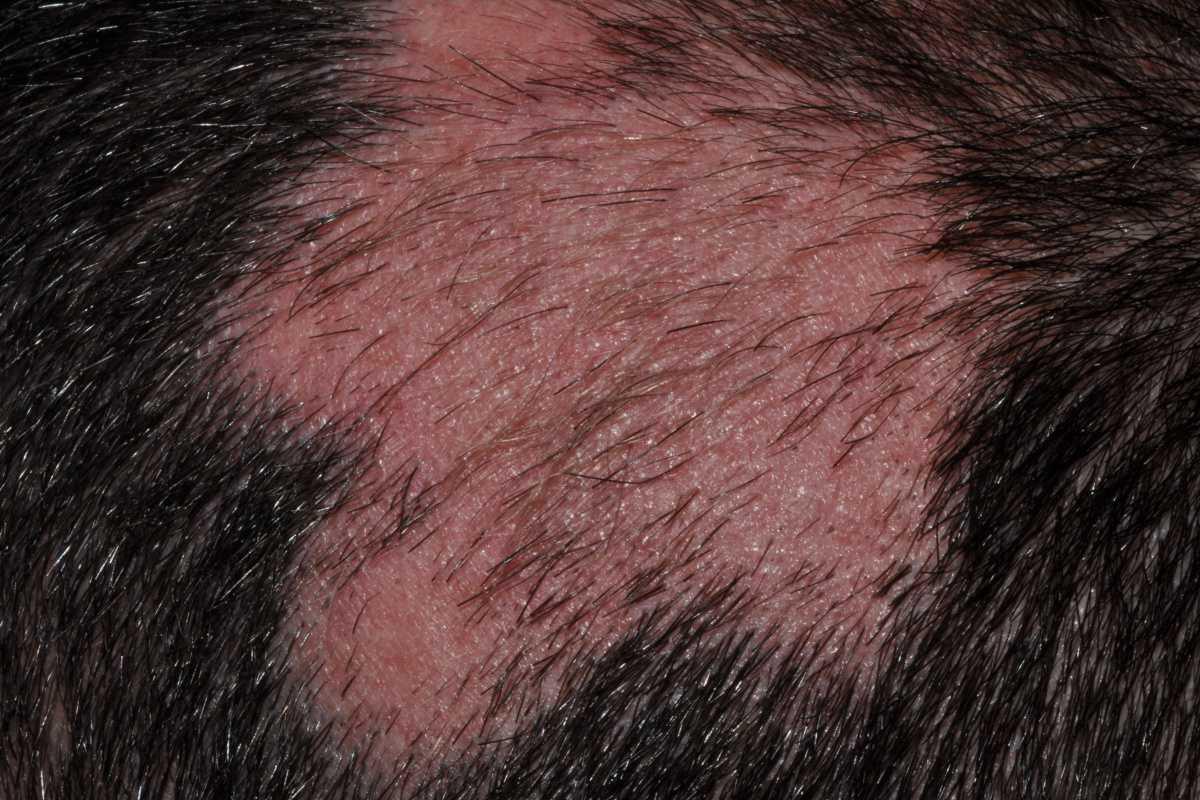 21755046-31021334