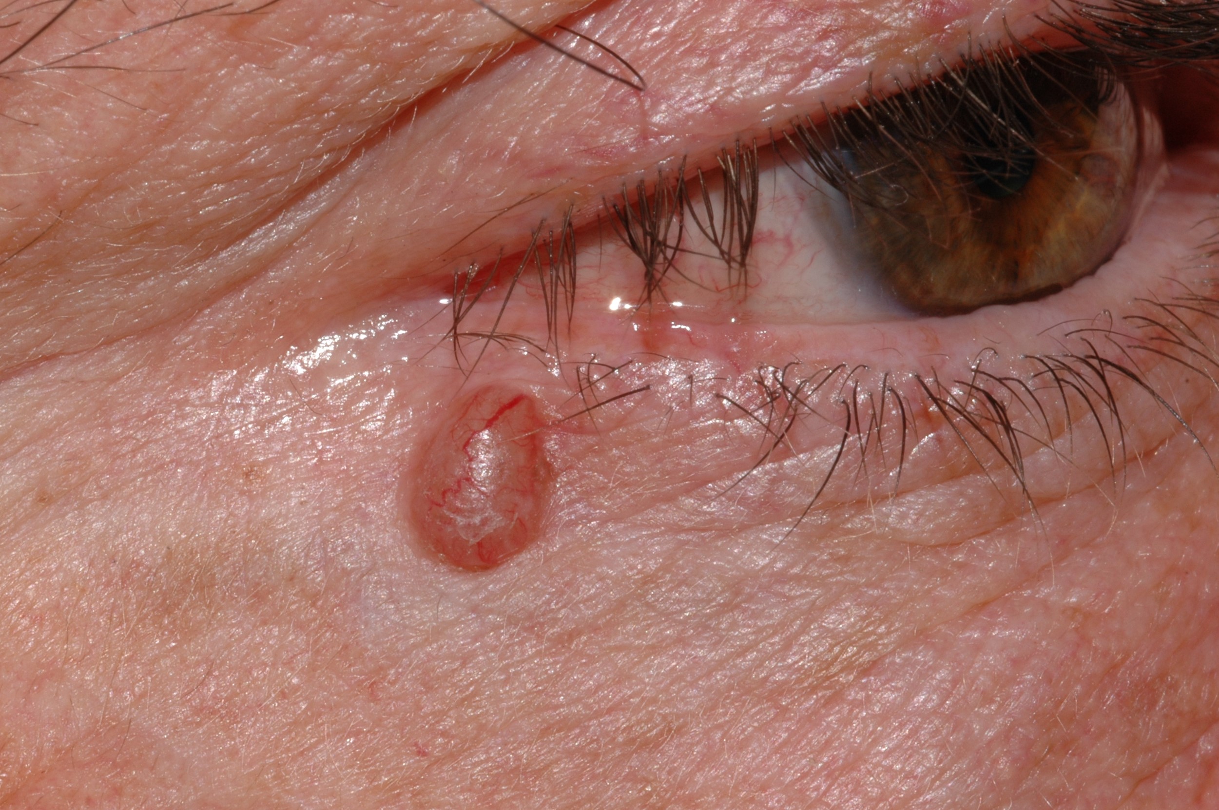 C44100~4
