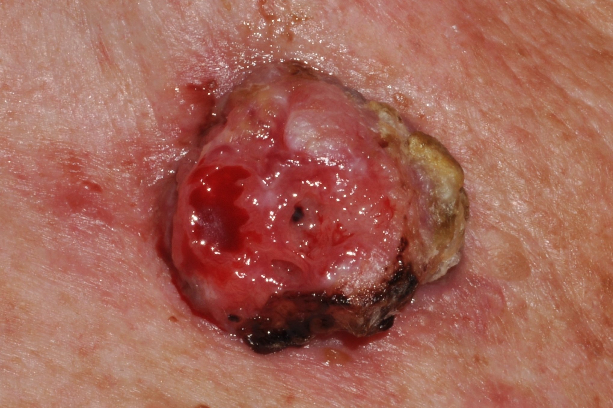 C44101~4