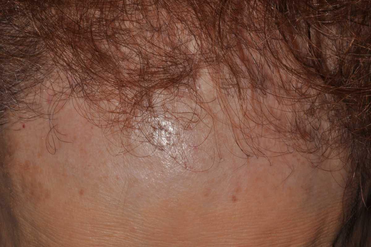 21755046-31688122