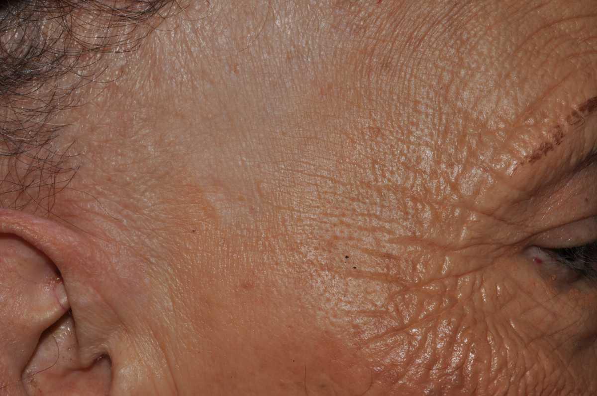 21755046-31646451