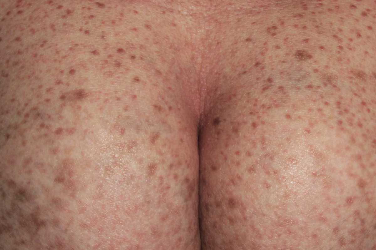 21755043-27231787