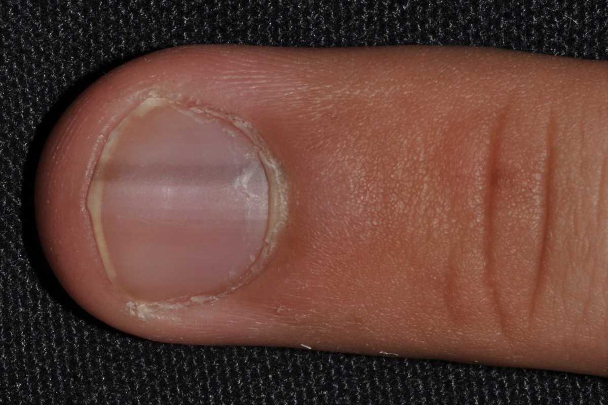 21755046-31693628
